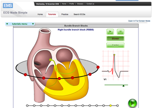 ecg_made_simple-1