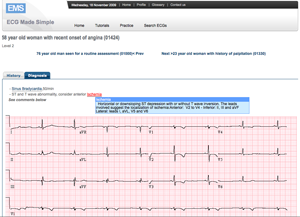 ecg_made_simple-2