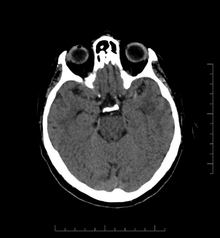 Diagnostic Imaging – Toronto Notes